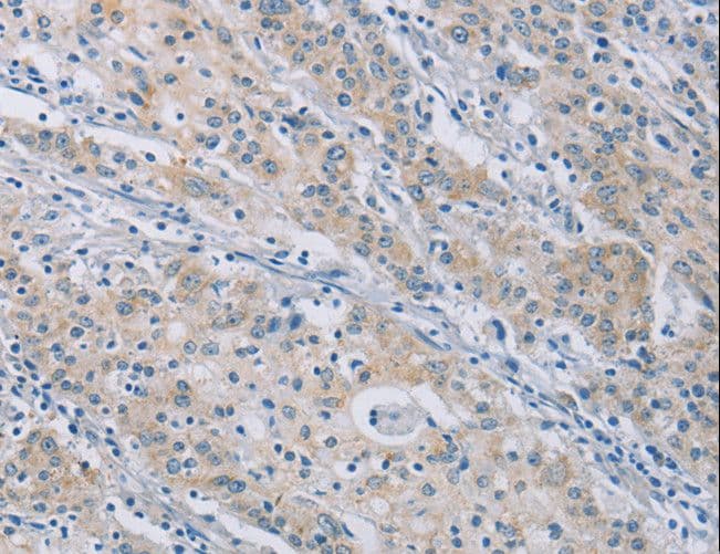 CERKL Antibody