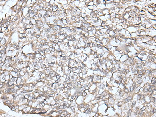 IFN Beta / Interferon Beta Antibody