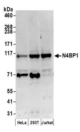 Polyclonal Rabbit anti-Human N4BP1 Antibody (aa250-300, WB)
