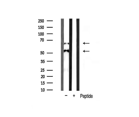 CAMK2B / CaMKII Beta Antibody