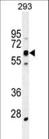 KRBA2 Antibody (aa157-186)
