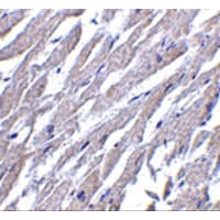 Polyclonal Rabbit anti-Human GPR44 / CRTH2 Antibody (IHC, IF, WB)