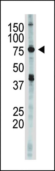 IKBKE / IKKI / IKKE Antibody (aa686-716)