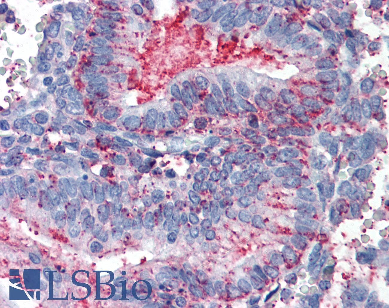 IHC-plus™ Polyclonal Rabbit anti-Human CDCP1 Antibody (Extracellular Domain, IHC)