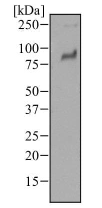 Monoclonal Mouse anti-Human TLR2 Antibody (clone 67N8F8, aa227-398, IHC, WB)