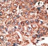 Polyclonal Rabbit anti-Human MMP20 Antibody (aa233-262, IHC, WB)
