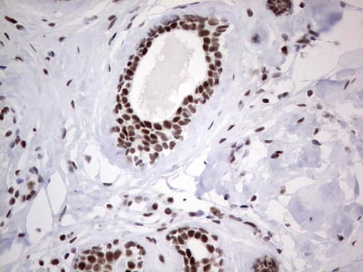 Monoclonal Mouse anti-Human HDAC9 Antibody (clone OTI7G2, aa181-460, IHC, WB)