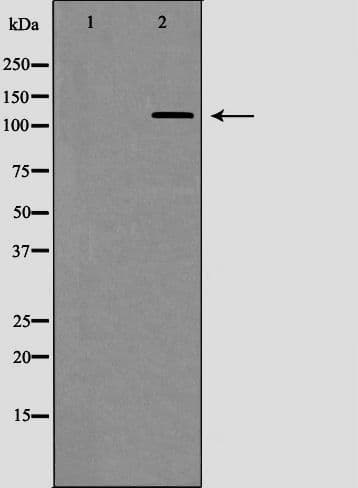 TERT / Telomerase Antibody