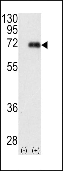 PRKCI / PKC Iota Antibody (aa176-207)