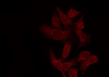 APOE / Apolipoprotein E Antibody