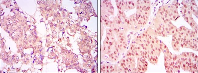 Monoclonal Mouse anti-Human PRMT4 / CARM1 Antibody (clone 3H2, IHC, IF, WB)