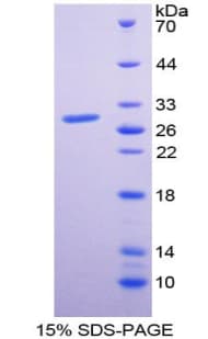 Rat TLR10 Protein (Recombinant His-T7)