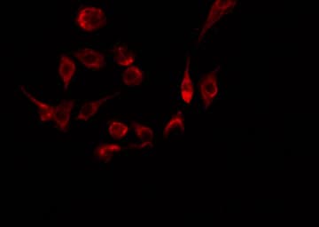 Polyclonal Rabbit anti-Human STAG3 Antibody (IF, WB)