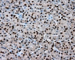 ERCC1 Antibody (clone OTI2H5)