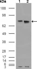 ER Alpha / Estrogen Receptor Antibody (clone 5D4B1)