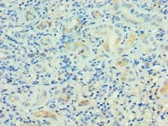Polyclonal Rabbit anti-Human PSG1 / CD66f Antibody (aa180-419, IHC)