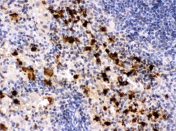 S100A9 / MRP14 Antibody