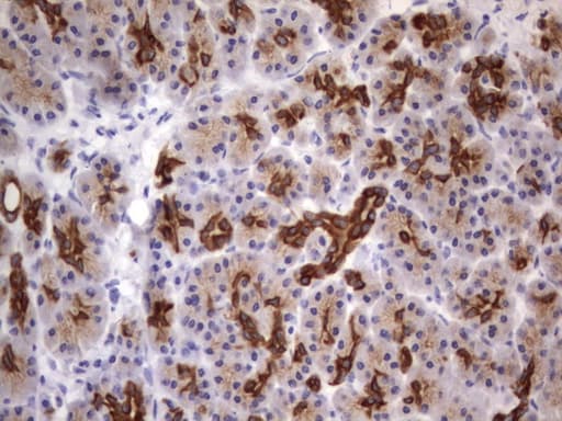Acidic Cytokeratin Antibody (clone 8F5)