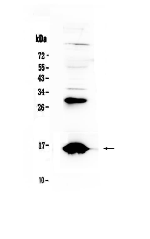 HBD / Hemoglobin Delta Antibody