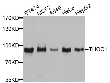 p84 / THOC1 Antibody