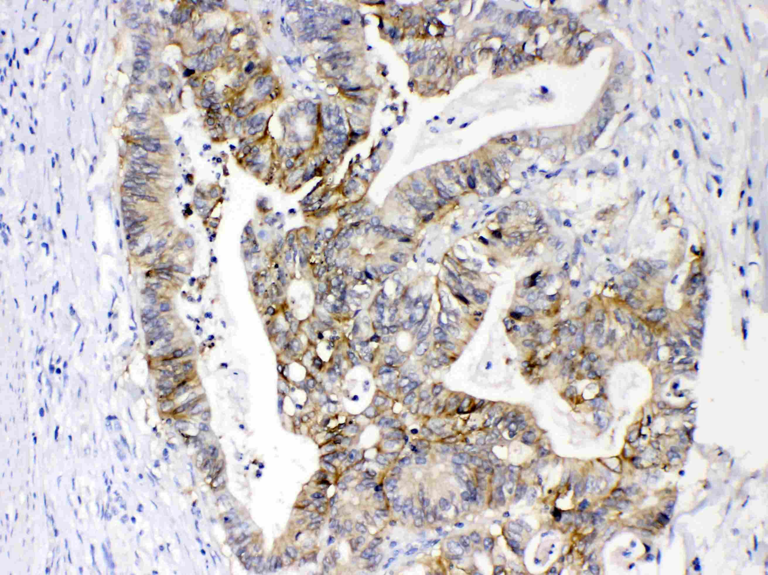 EPCAM Antibody