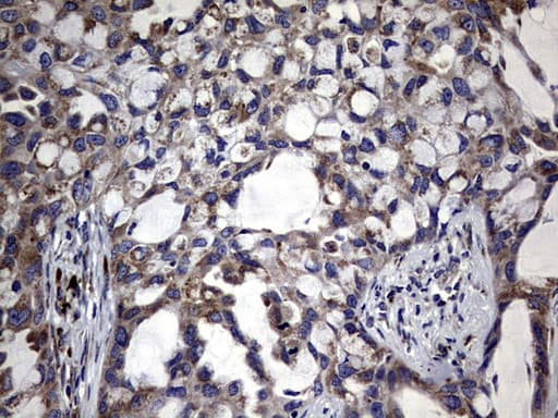 DDOST / OST48 Antibody (aa131-378, clone OTI2H2)