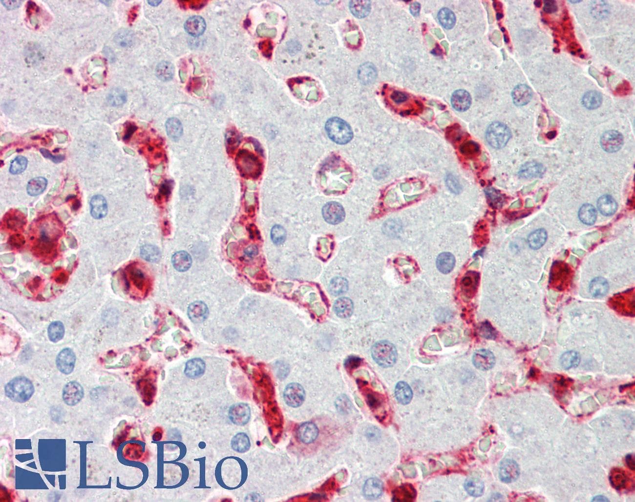 PathPlus™ Polyclonal Rabbit anti-Human CFL1 / Cofilin Antibody (aa4-32, IHC, WB)