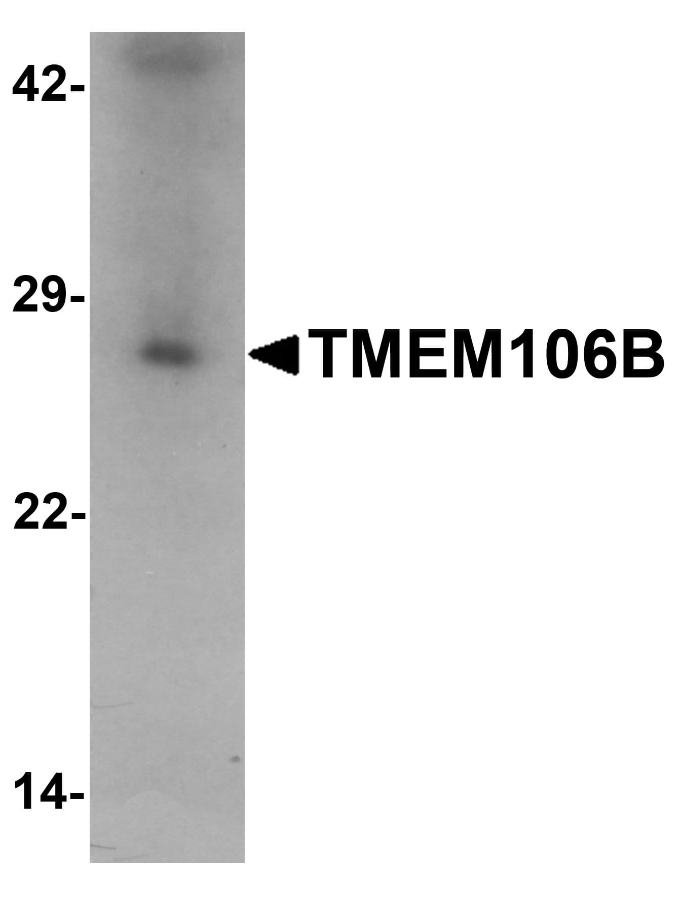 TMEM106B Antibody