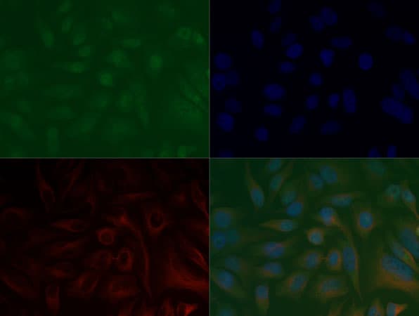 HIST3H3 Antibody (Me3-Lys36)