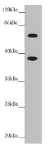 Polyclonal Rabbit anti-Human SLC39A4 / ZIP4 Antibody (IHC, WB)