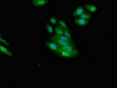 Polyclonal Rabbit anti-Human NMI Antibody (IHC, IF, WB)