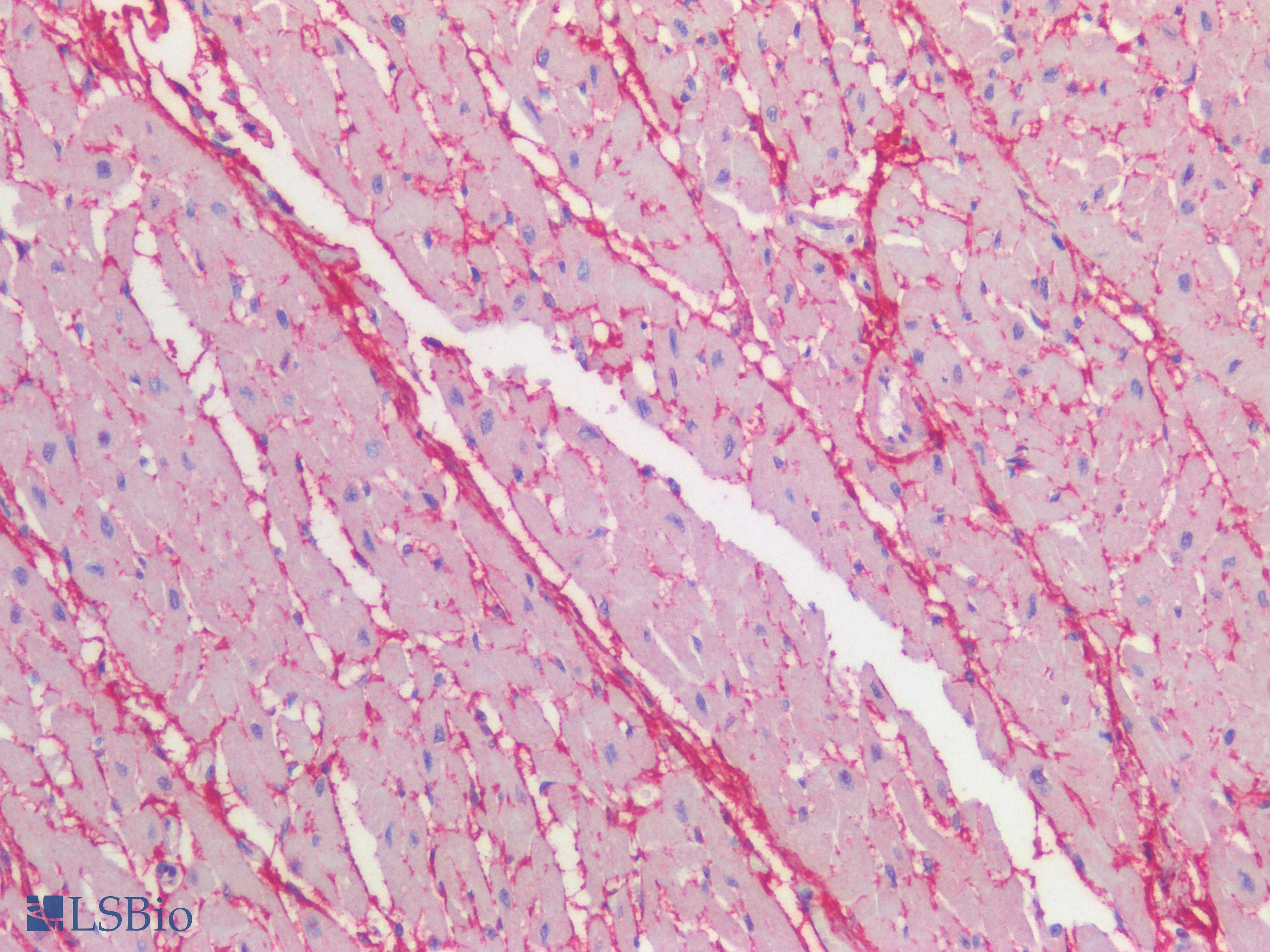 PathPlus™ FBN1 / Fibrillin 1 Antibody