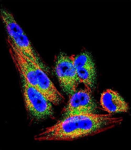 TIMP1 Antibody (aa41-70)