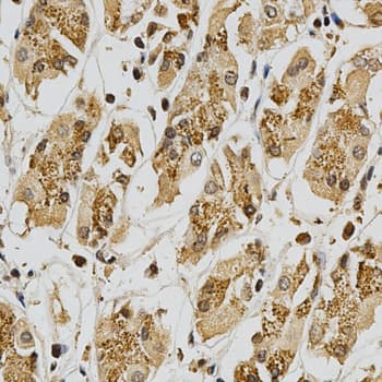 Polyclonal Rabbit anti-Human GSTT1 Antibody (IHC, WB)