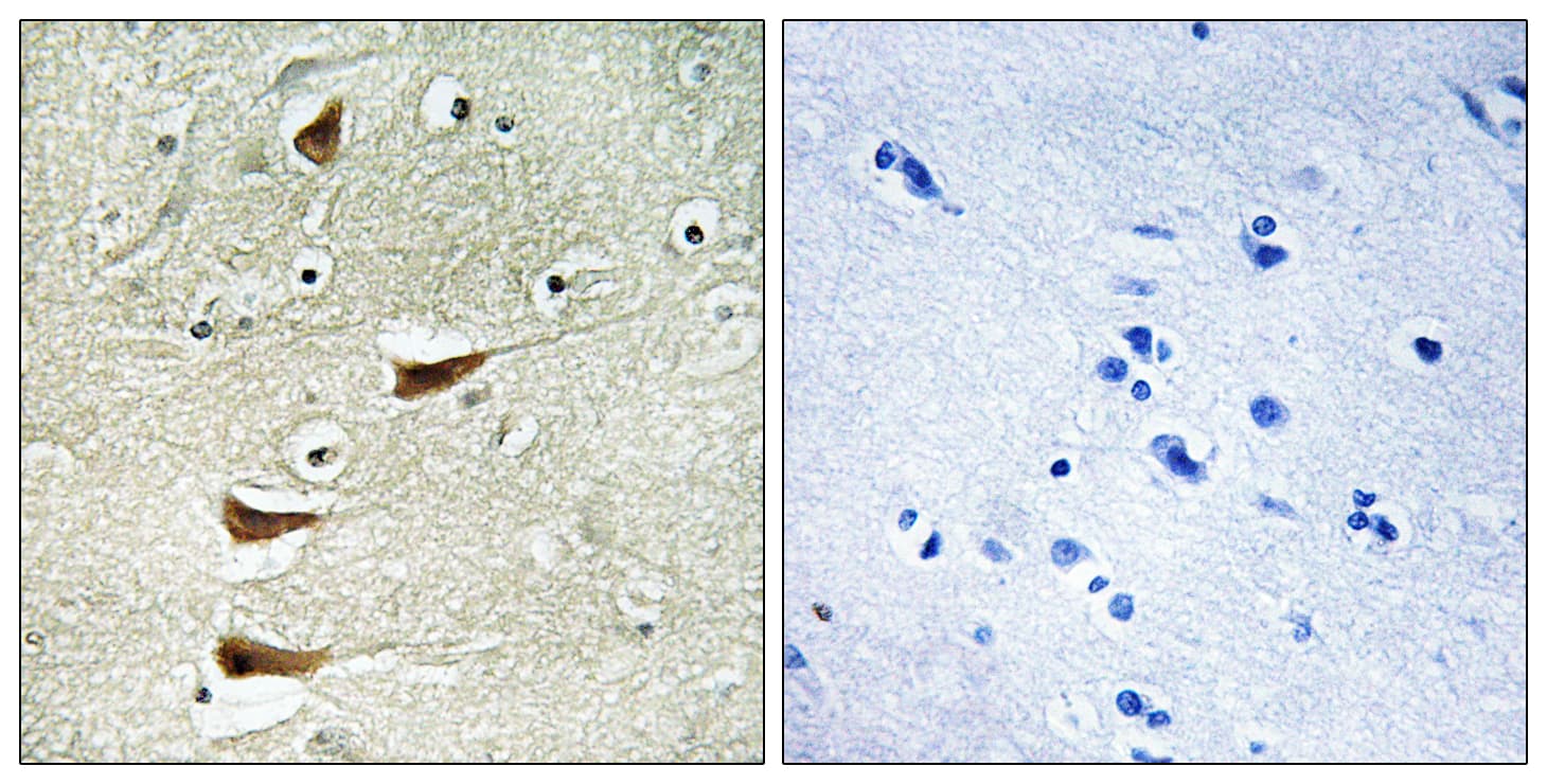 MAP3K10 / MLK2 Antibody (aa391-440)