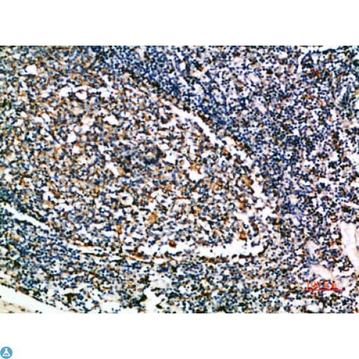 CSTA / Cystatin A Antibody