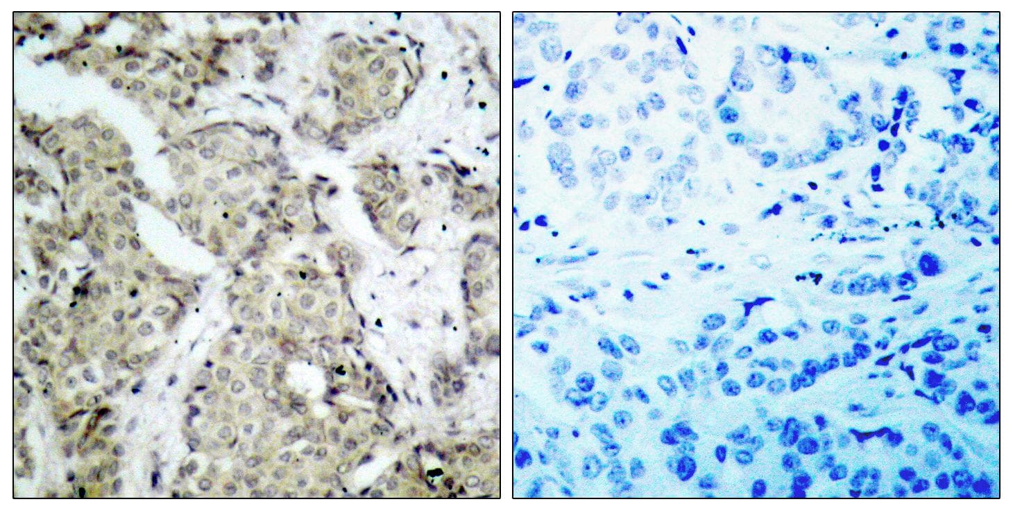 MAP2K3 / MEK3 / MKK3 Antibody (phospho-Ser189)