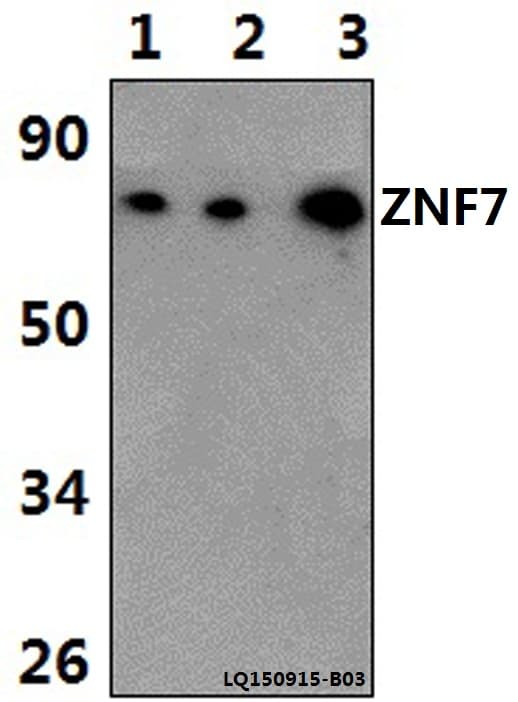 Polyclonal Rabbit anti-Human ZNF7 Antibody (WB)