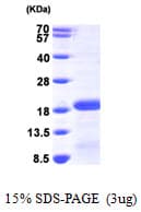 Human PDRG1 Protein (Recombinant His)