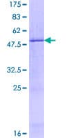 Human TINAGL1 / Lipocalin 7 Protein (Recombinant GST)