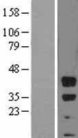 Human BMI1 / PCGF4 Protein (Over-Expression Lysate Myc-DDK (Flag))