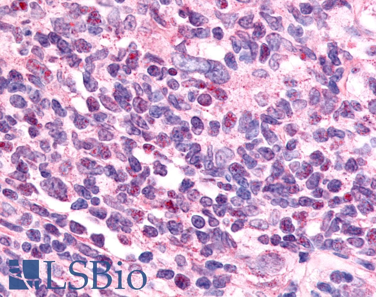 PathPlus™ EAR2 / NR2F6 Antibody (N-Terminus)