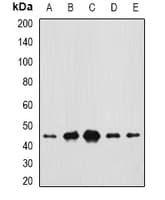 CEP44 / KIAA1712 Antibody