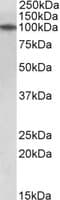 IHC-plus™ TXNDC11 Antibody (aa114-126)