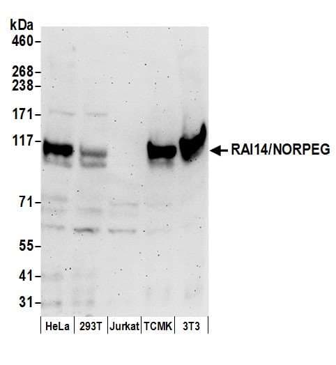 RAI14 Antibody (aa1-50)