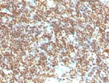 DNA ds Antibody (clone DRNC1-1)