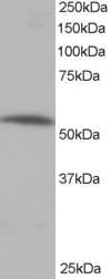 IHC-plus™ PPP2R5A Antibody (aa473-486)