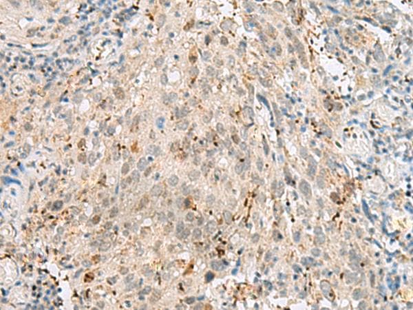 GTF3C2 Antibody