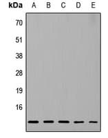 Polyclonal Rabbit anti-Human RPL37 / Ribosomal Protein L37 Antibody (Internal, IHC, WB)