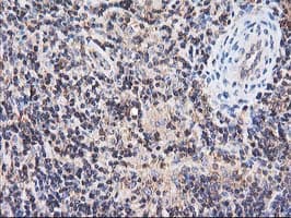 HARS2 Antibody (clone OTI3F1)